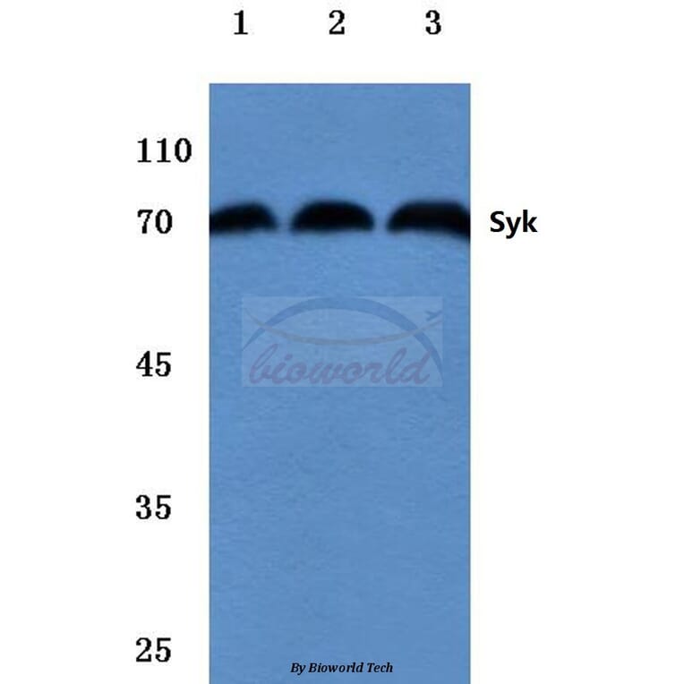 Anti-Syk (L519) Antibody from Bioworld Technology (BS1344) - Antibodies.com