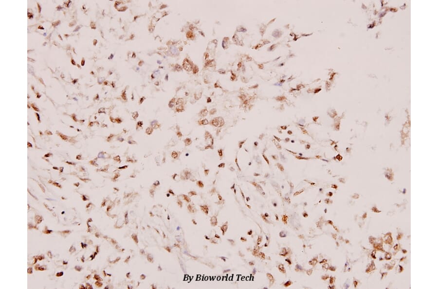 Anti-Syk (L519) Antibody from Bioworld Technology (BS1344) - Antibodies.com