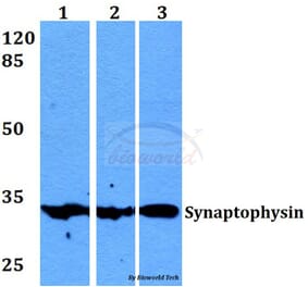 Anti-Synaptophysin (L128) Antibody from Bioworld Technology (BS1345) - Antibodies.com