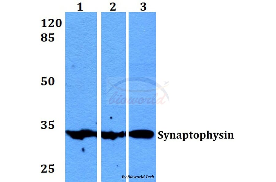 Anti-Synaptophysin (L128) Antibody from Bioworld Technology (BS1345) - Antibodies.com