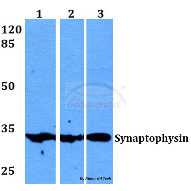 Anti-Synaptophysin (L128) Antibody from Bioworld Technology (BS1345) - Antibodies.com