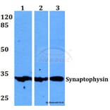Anti-Synaptophysin (L128) Antibody from Bioworld Technology (BS1345) - Antibodies.com