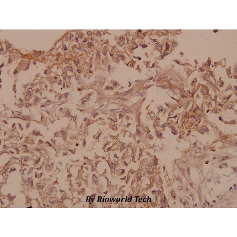 Anti-Synaptophysin (L128) Antibody from Bioworld Technology (BS1345) - Antibodies.com