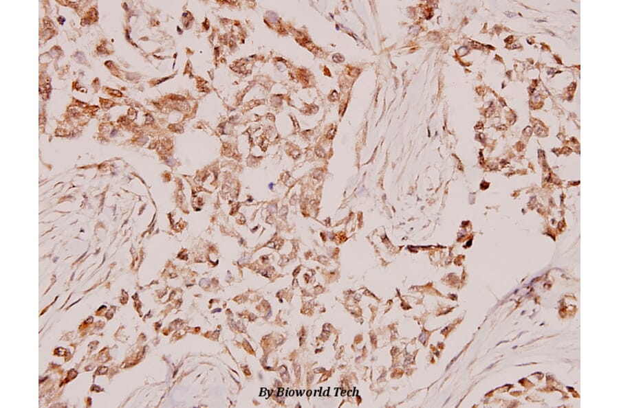Anti-Synaptotagmin (M303) Antibody from Bioworld Technology (BS1347) - Antibodies.com