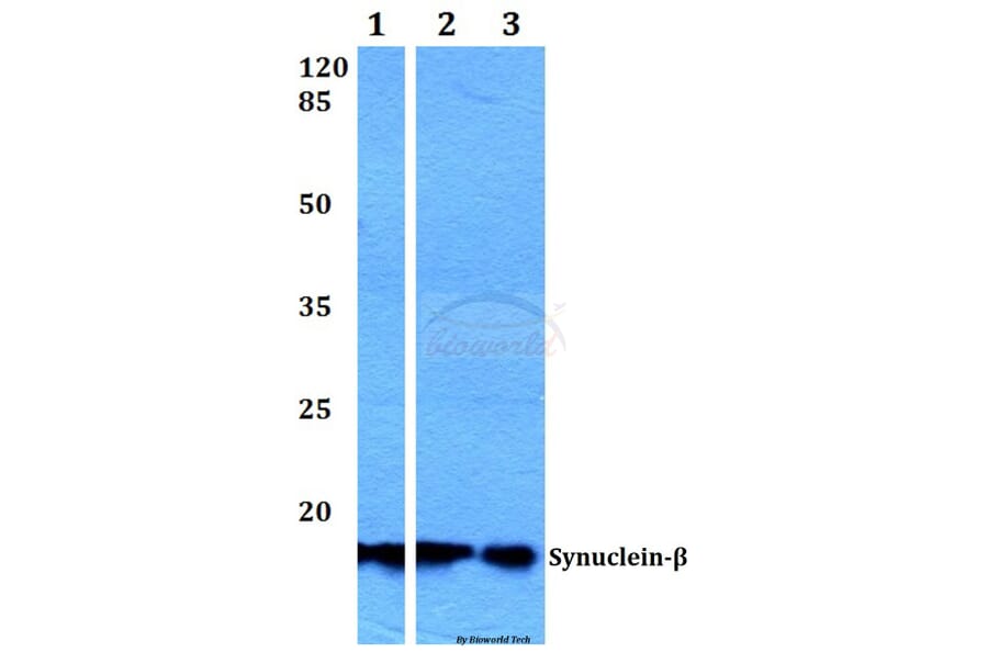 Anti-Synuclein-β (S118) Antibody from Bioworld Technology (BS1348) - Antibodies.com