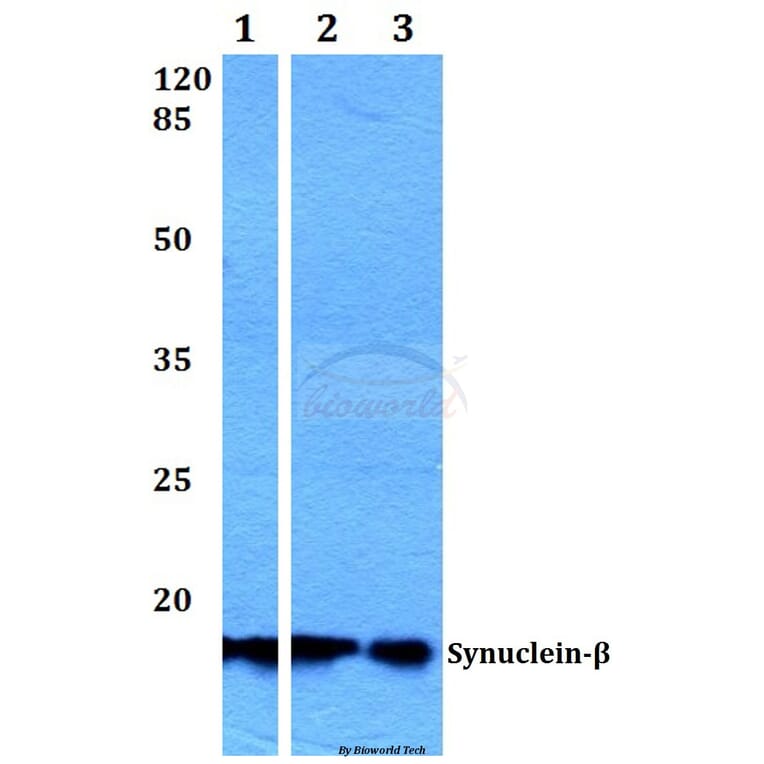 Anti-Synuclein-β (S118) Antibody from Bioworld Technology (BS1348) - Antibodies.com