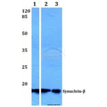 Anti-Synuclein-β (S118) Antibody from Bioworld Technology (BS1348) - Antibodies.com