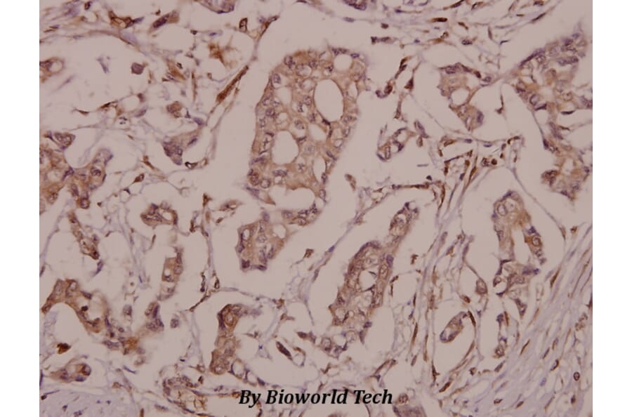 Anti-Synuclein-β (S118) Antibody from Bioworld Technology (BS1348) - Antibodies.com
