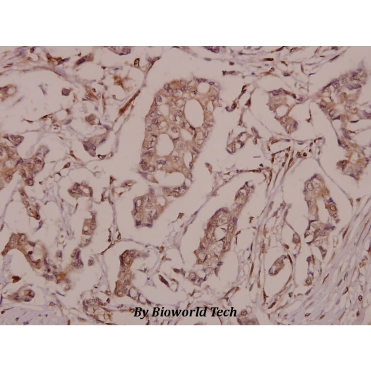Anti-Synuclein-β (S118) Antibody from Bioworld Technology (BS1348) - Antibodies.com