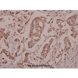 Anti-Synuclein-β (S118) Antibody from Bioworld Technology (BS1348) - Antibodies.com