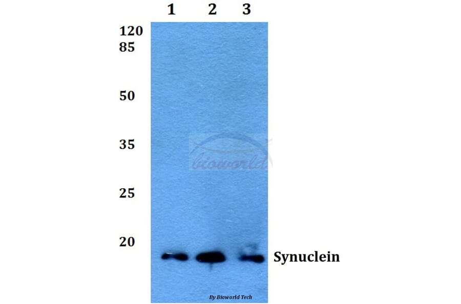 Anti-Synuclein-pan (A19) Antibody from Bioworld Technology (BS1349) - Antibodies.com