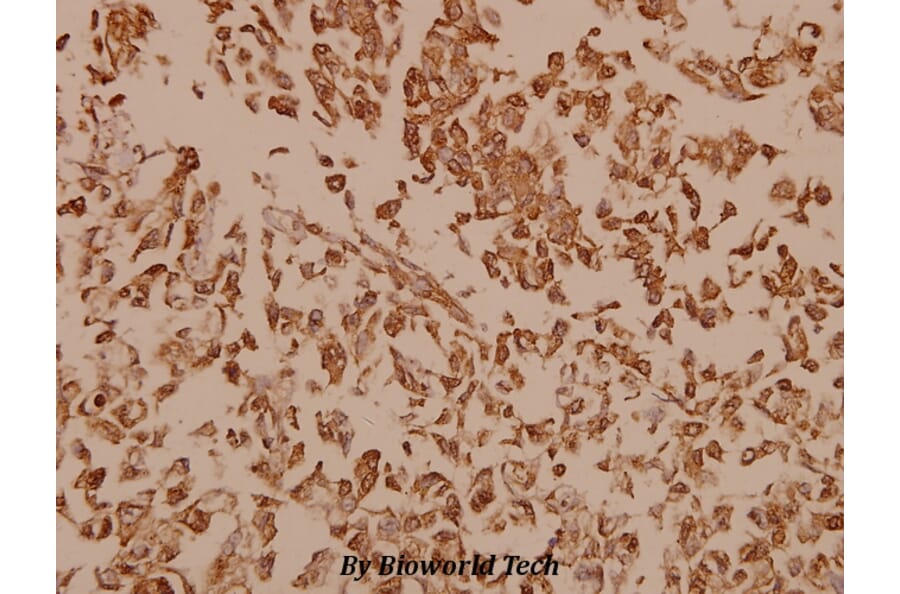 Anti-Synuclein-pan (A19) Antibody from Bioworld Technology (BS1349) - Antibodies.com