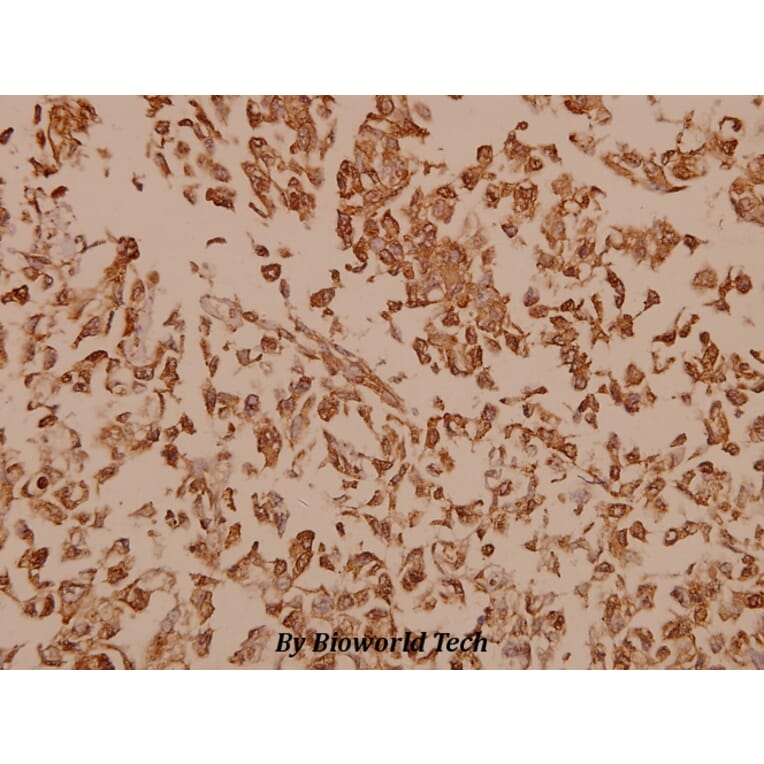 Anti-Synuclein-pan (A19) Antibody from Bioworld Technology (BS1349) - Antibodies.com