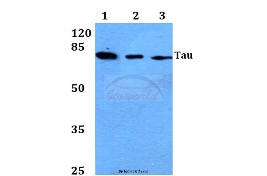 Anti-Tau (T175) Antibody from Bioworld Technology (BS1350) - Antibodies.com