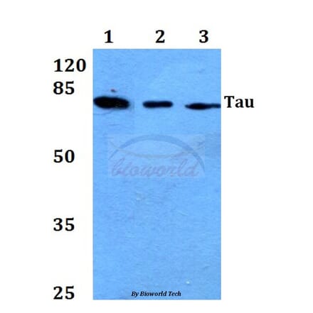 Anti-Tau (T175) Antibody from Bioworld Technology (BS1350) - Antibodies.com