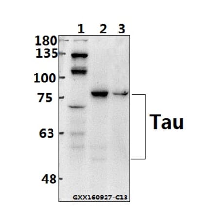 Anti-Tau (S199) Antibody from Bioworld Technology (BS1351) - Antibodies.com