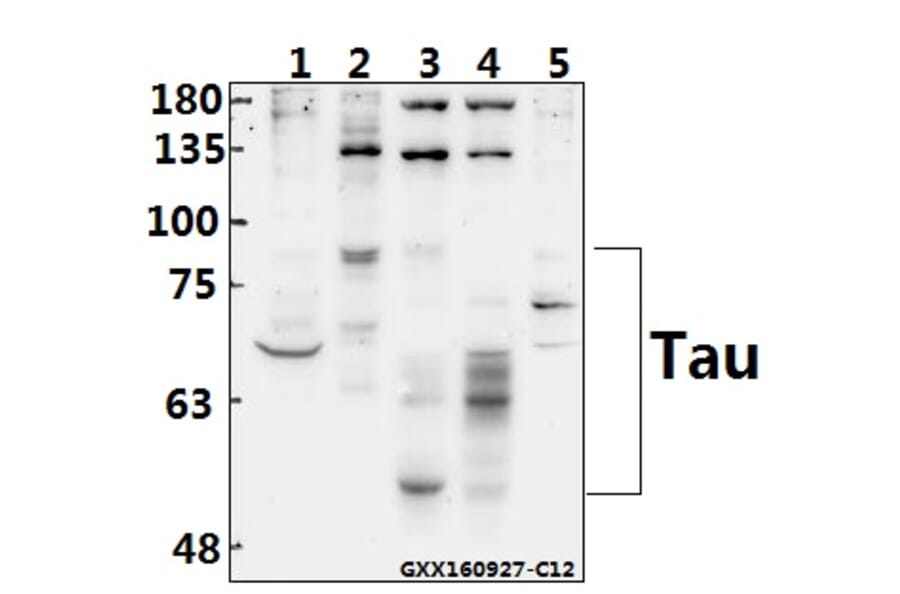 Anti-Tau (S208) Antibody from Bioworld Technology (BS1352) - Antibodies.com