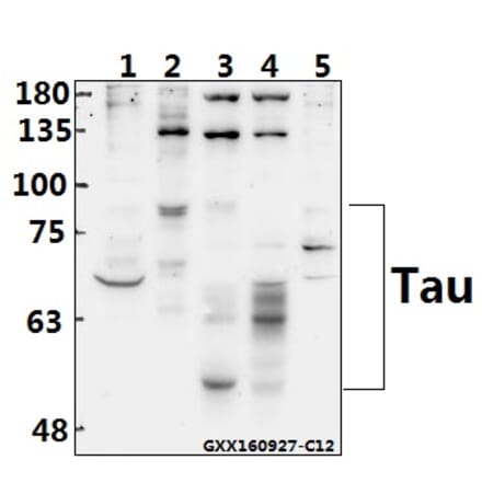 Anti-Tau (S208) Antibody from Bioworld Technology (BS1352) - Antibodies.com
