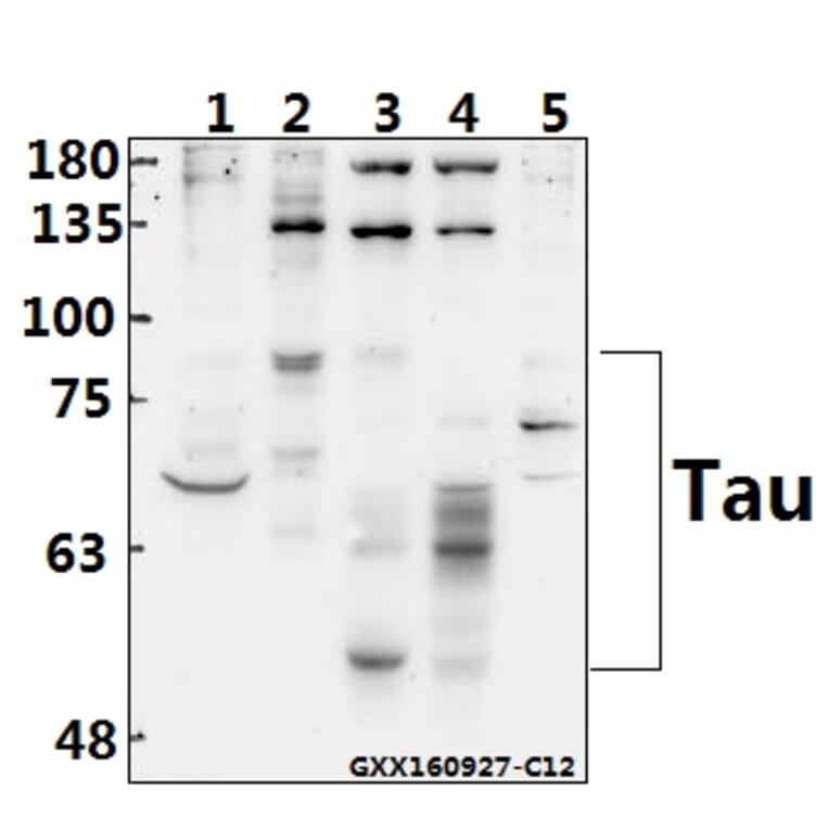 Anti-Tau (S208) Antibody from Bioworld Technology (BS1352) - Antibodies.com