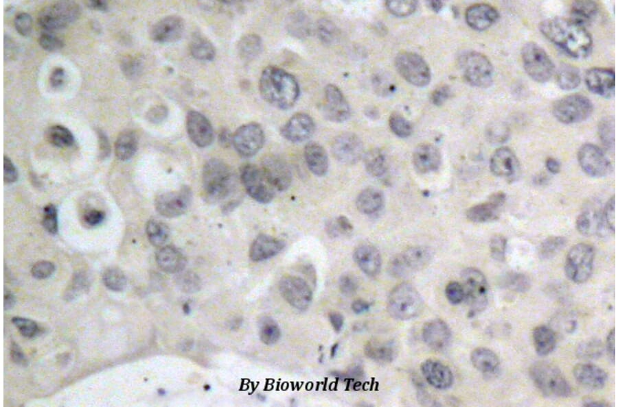 Anti-Tau (S208) Antibody from Bioworld Technology (BS1352) - Antibodies.com