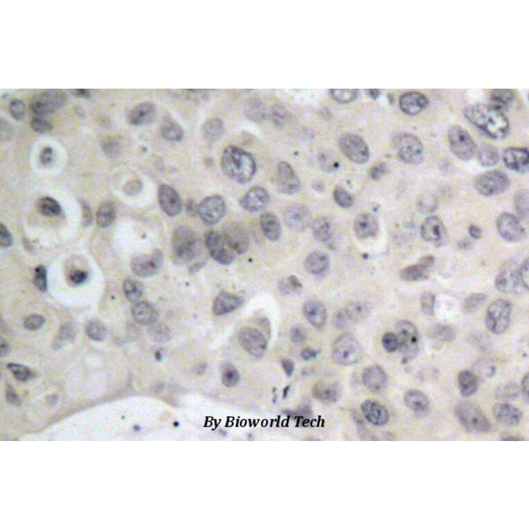 Anti-Tau (S208) Antibody from Bioworld Technology (BS1352) - Antibodies.com
