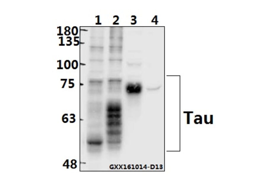 Anti-Tau (K225) Antibody from Bioworld Technology (BS1353) - Antibodies.com