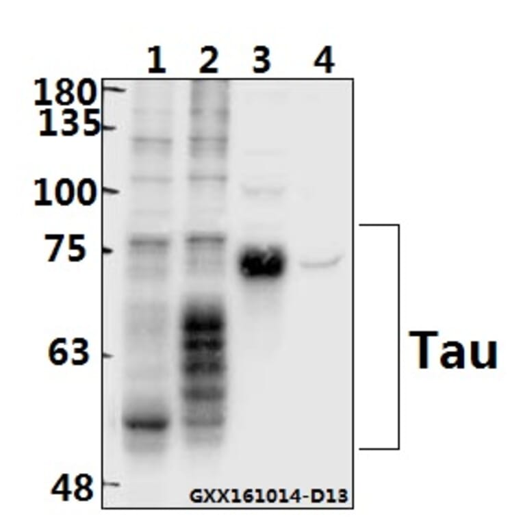 Anti-Tau (K225) Antibody from Bioworld Technology (BS1353) - Antibodies.com