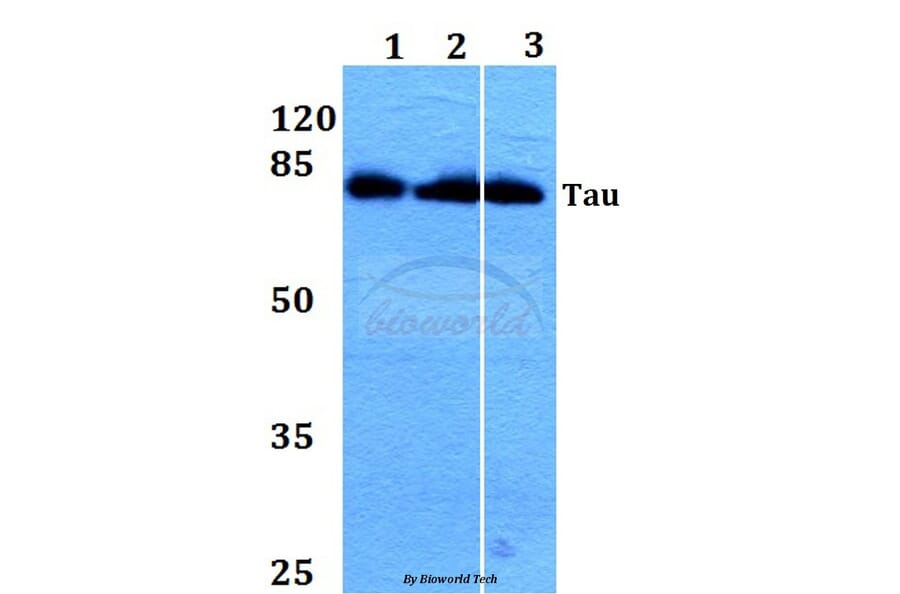 Anti-Tau (V229) Antibody from Bioworld Technology (BS1354) - Antibodies.com