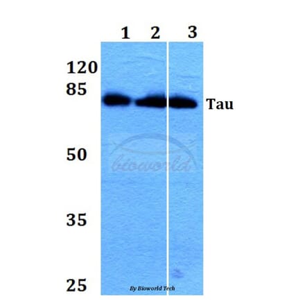 Anti-Tau (V229) Antibody from Bioworld Technology (BS1354) - Antibodies.com