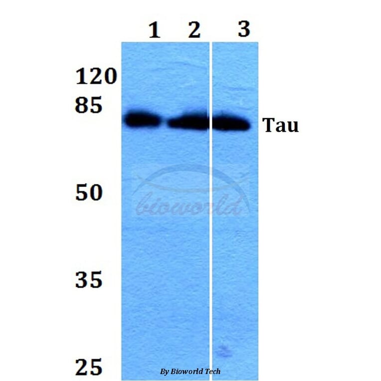 Anti-Tau (V229) Antibody from Bioworld Technology (BS1354) - Antibodies.com