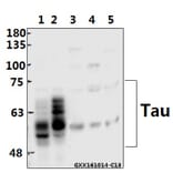 Anti-Tau (A390) Antibody from Bioworld Technology (BS1357) - Antibodies.com