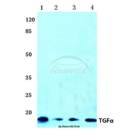 Anti-TGFα (R139) Antibody from Bioworld Technology (BS1359) - Antibodies.com