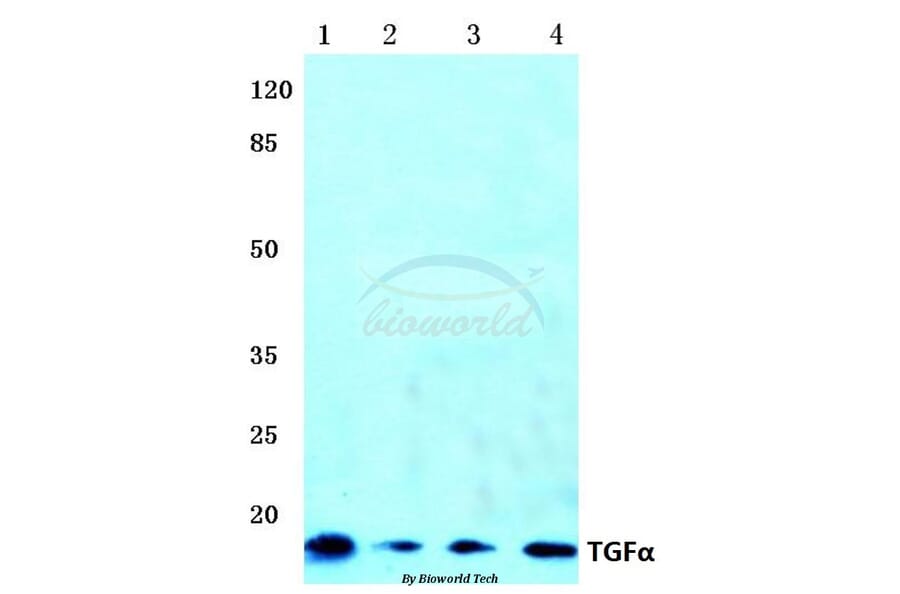 Anti-TGFα (R139) Antibody from Bioworld Technology (BS1359) - Antibodies.com