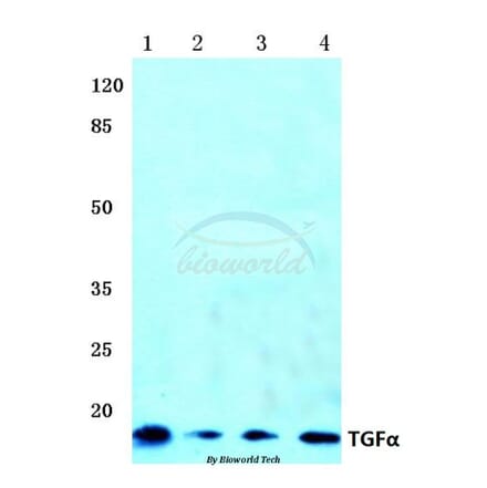 Anti-TGFα (R139) Antibody from Bioworld Technology (BS1359) - Antibodies.com