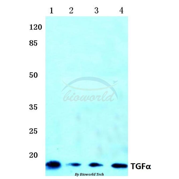 Anti-TGFα (R139) Antibody from Bioworld Technology (BS1359) - Antibodies.com