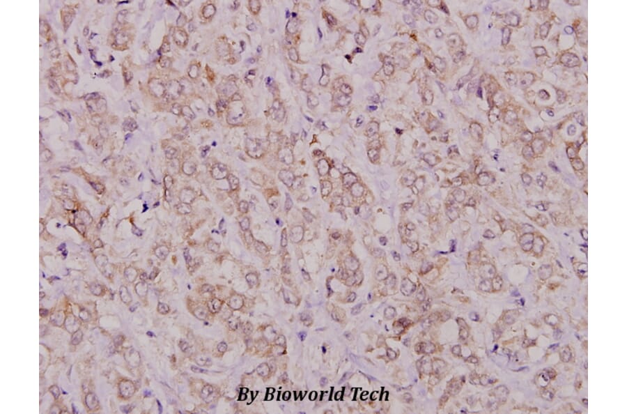 Anti-TGFα (R139) Antibody from Bioworld Technology (BS1359) - Antibodies.com
