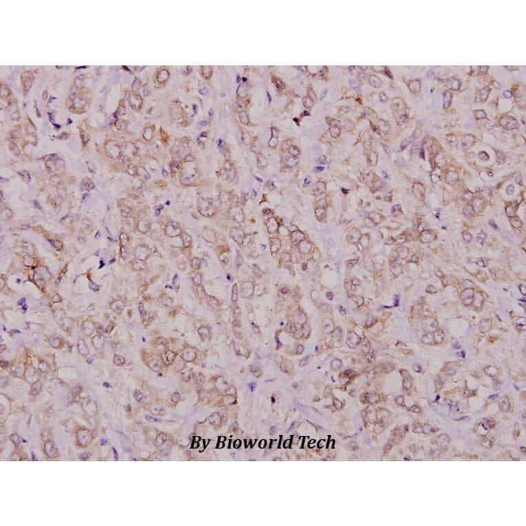 Anti-TGFα (R139) Antibody from Bioworld Technology (BS1359) - Antibodies.com