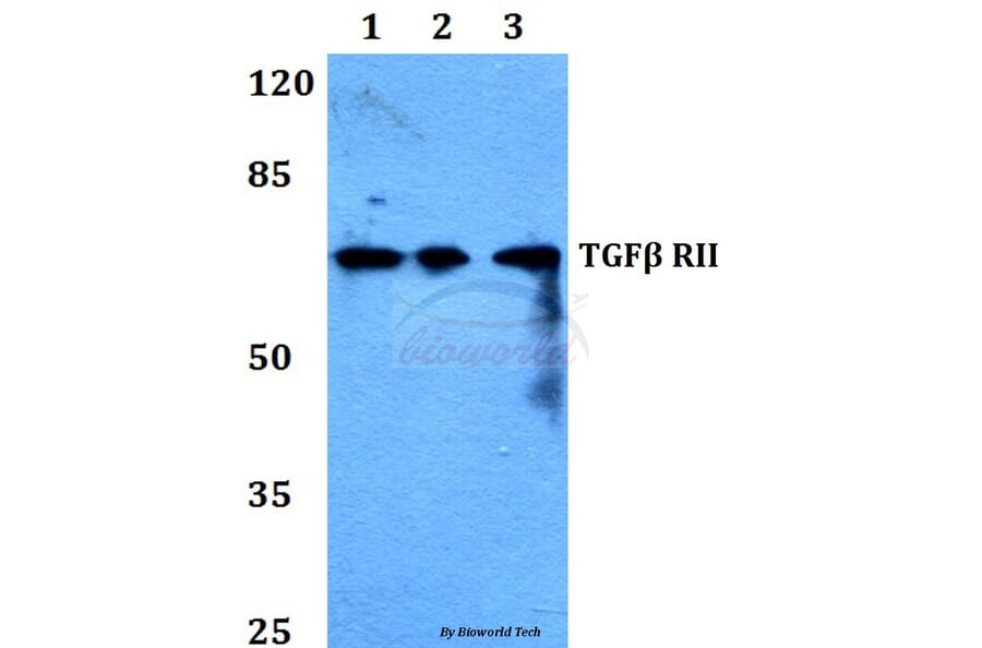 Anti-TGFβ RII (I122) Antibody from Bioworld Technology (BS1360) - Antibodies.com