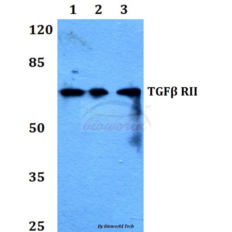 Anti-TGFβ RII (I122) Antibody from Bioworld Technology (BS1360) - Antibodies.com