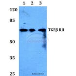 Anti-TGFβ RII (I122) Antibody from Bioworld Technology (BS1360) - Antibodies.com
