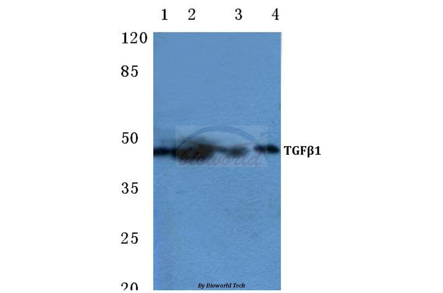 Anti-TGFβ1 (Y369) Antibody from Bioworld Technology (BS1361) - Antibodies.com