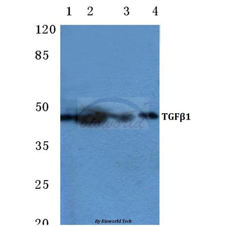 Anti-TGFβ1 (Y369) Antibody from Bioworld Technology (BS1361) - Antibodies.com
