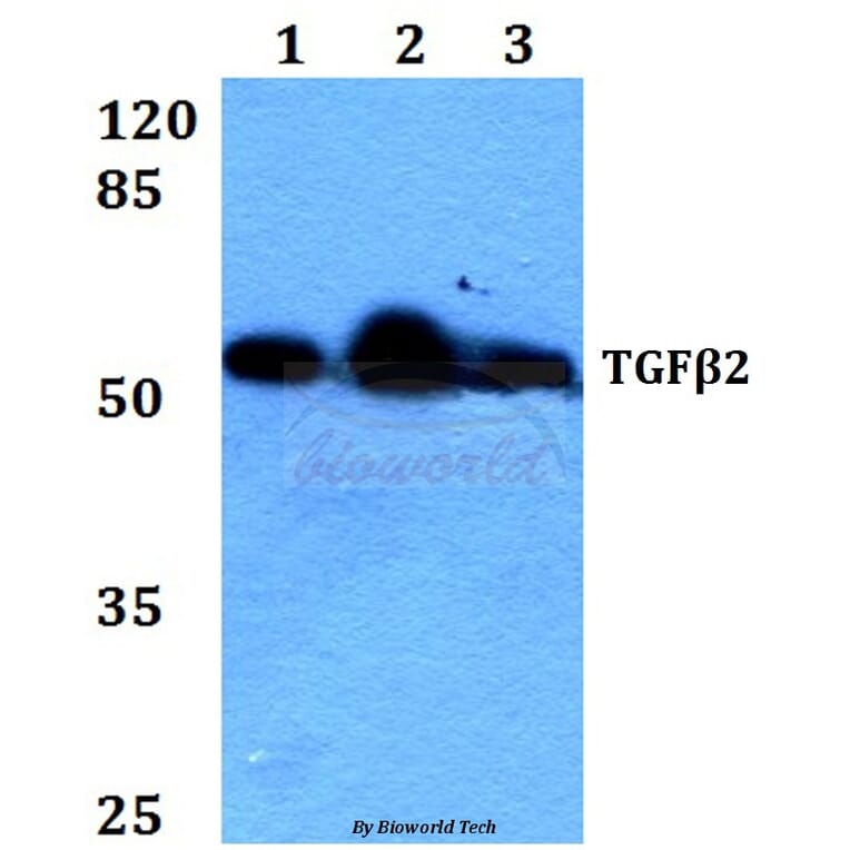 Anti-TGFβ2 (L388) Antibody from Bioworld Technology (BS1362) - Antibodies.com