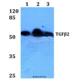 Anti-TGFβ2 (L388) Antibody from Bioworld Technology (BS1362) - Antibodies.com