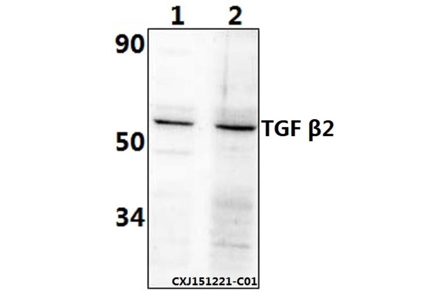 Anti-TGFβ2 (L388) Antibody from Bioworld Technology (BS1362) - Antibodies.com