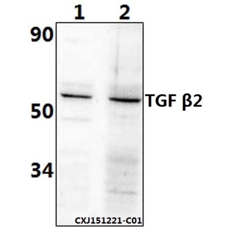 Anti-TGFβ2 (L388) Antibody from Bioworld Technology (BS1362) - Antibodies.com