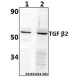 Anti-TGFβ2 (L388) Antibody from Bioworld Technology (BS1362) - Antibodies.com