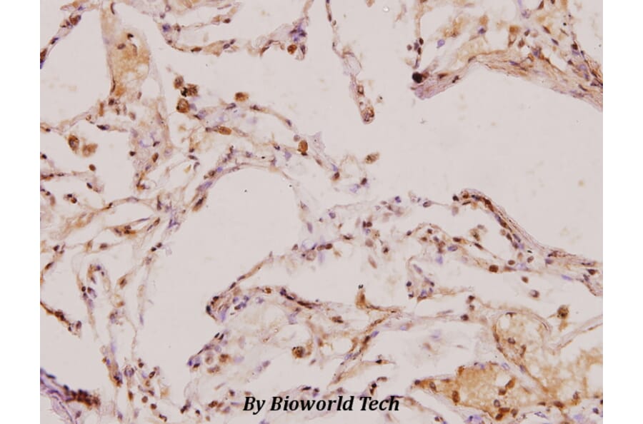Anti-TGFβ2 (L388) Antibody from Bioworld Technology (BS1362) - Antibodies.com