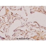 Anti-TGFβ2 (L388) Antibody from Bioworld Technology (BS1362) - Antibodies.com