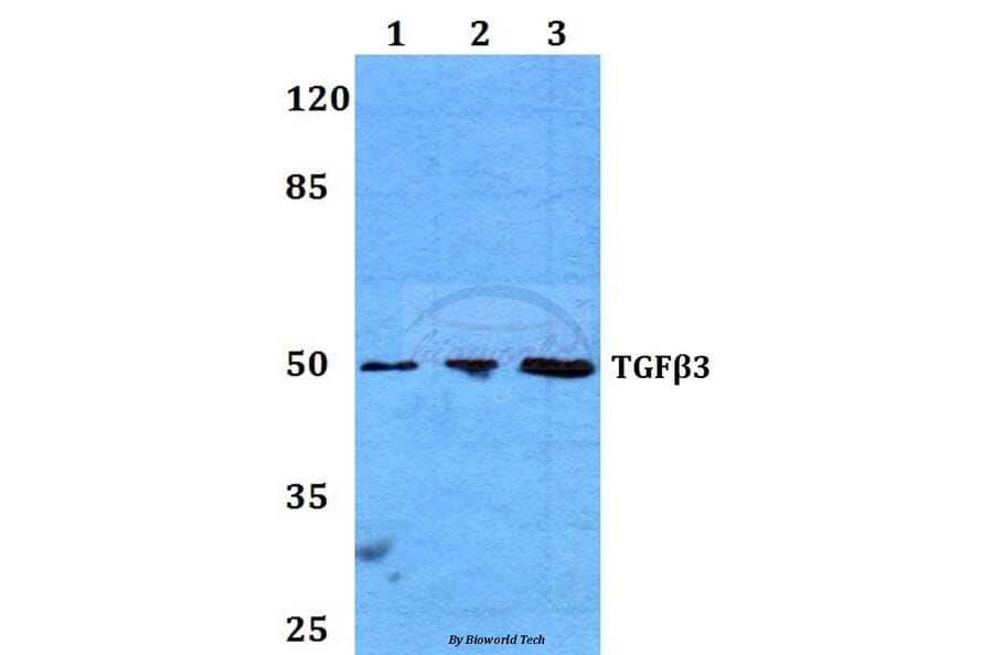 Anti-TGF β3 (G292) Antibody from Bioworld Technology (BS1363) - Antibodies.com